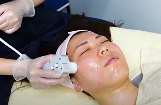 エレクトロポレーション | たるみ・しみ治療 | レディアス美容クリニック恵比寿