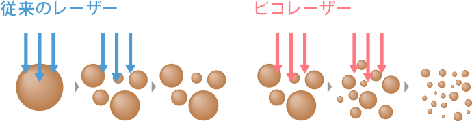 従来のレーザーとピコレーザーの比較イメージ